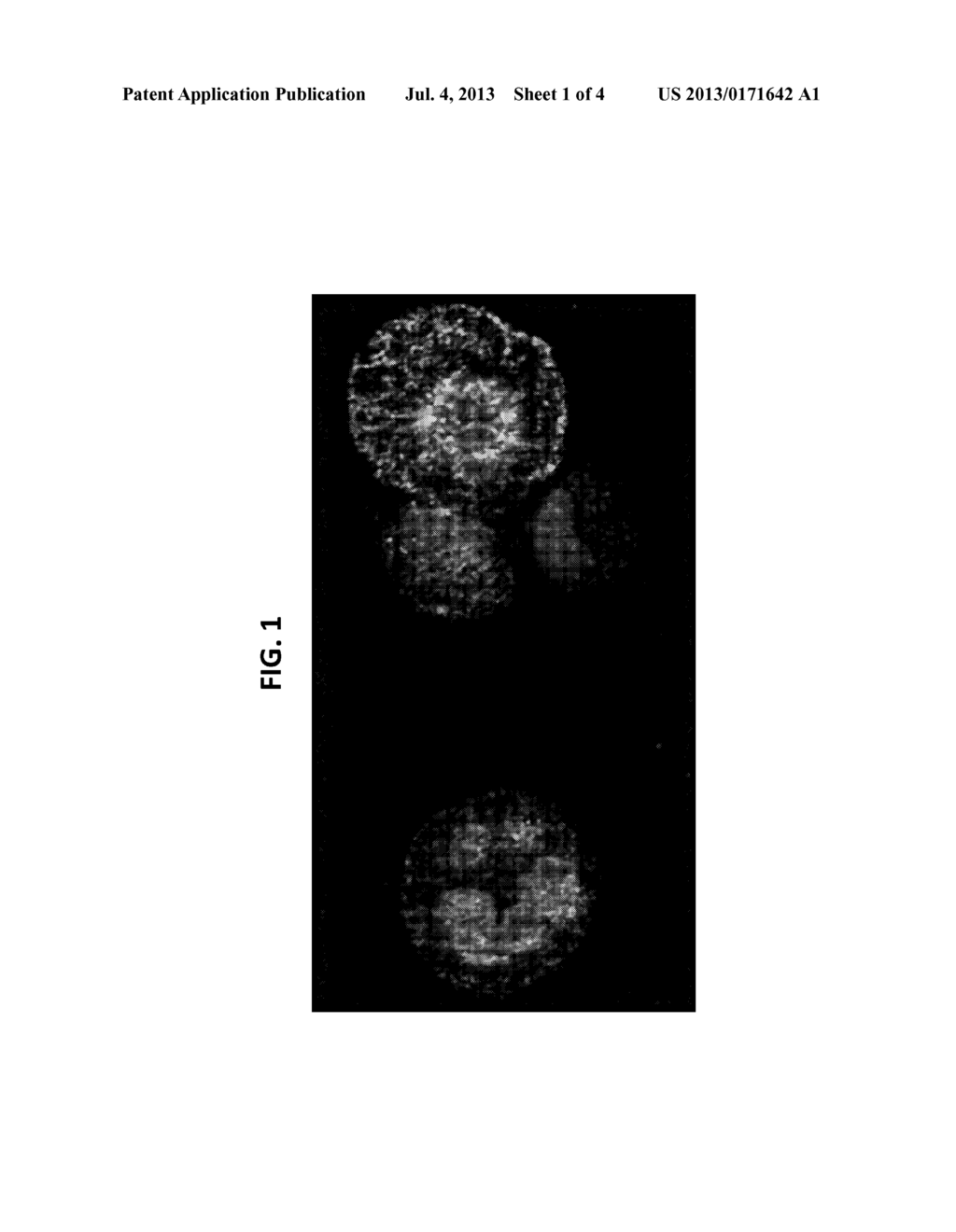 AUTOMATED ANALYSIS OF CIRCULATING TUMOR CELLS - diagram, schematic, and image 02