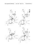 REDUCTION OF CEPHALIC ABSORPTION OF RADIATION FROM MOBILE COMMUNICATION     DEVICES diagram and image