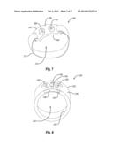 Exercise Device Control Ring diagram and image