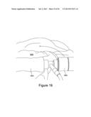 ROBOTIC CAPSULE ENDOSCOPE FOR MINIMALLY INVASIVE SURGICAL PROCEDURES,     MICRO-PATTERNED TREADS FOR FRICTION ENHANCEMENT OF A ROBOTIC CAPSULE     ENDOSCOPE IN A BIOLOGICAL ENVIRONMENT, AND PROCESS FOR FABRICATION OF     MICRO-TREADS diagram and image