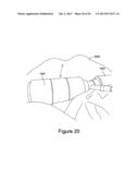 ROBOTIC CAPSULE ENDOSCOPE FOR MINIMALLY INVASIVE SURGICAL PROCEDURES,     MICRO-PATTERNED TREADS FOR FRICTION ENHANCEMENT OF A ROBOTIC CAPSULE     ENDOSCOPE IN A BIOLOGICAL ENVIRONMENT, AND PROCESS FOR FABRICATION OF     MICRO-TREADS diagram and image