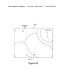 ROBOTIC CAPSULE ENDOSCOPE FOR MINIMALLY INVASIVE SURGICAL PROCEDURES,     MICRO-PATTERNED TREADS FOR FRICTION ENHANCEMENT OF A ROBOTIC CAPSULE     ENDOSCOPE IN A BIOLOGICAL ENVIRONMENT, AND PROCESS FOR FABRICATION OF     MICRO-TREADS diagram and image