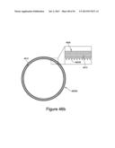 ROBOTIC CAPSULE ENDOSCOPE FOR MINIMALLY INVASIVE SURGICAL PROCEDURES,     MICRO-PATTERNED TREADS FOR FRICTION ENHANCEMENT OF A ROBOTIC CAPSULE     ENDOSCOPE IN A BIOLOGICAL ENVIRONMENT, AND PROCESS FOR FABRICATION OF     MICRO-TREADS diagram and image