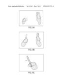 IMAGE-OVERLAY MEDICAL EVALUATION DEVICES AND TECHNIQUES diagram and image