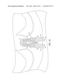 IMAGE-OVERLAY MEDICAL EVALUATION DEVICES AND TECHNIQUES diagram and image