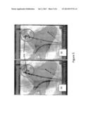 METHOD FOR PERFORMING DYNAMIC REGISTRATION, OVERLAYS, AND 3D VIEWS WITH     FLUOROSCOPIC IMAGES diagram and image