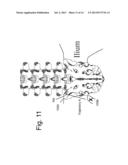 DEVICES AND METHODS FOR THE DIAGNOSIS AND TREATMENT OF SACRO-ILIAC JOINT     DISEASE diagram and image