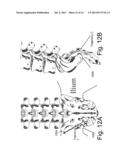 DEVICES AND METHODS FOR THE DIAGNOSIS AND TREATMENT OF SACRO-ILIAC JOINT     DISEASE diagram and image