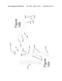 DEVICES AND METHODS FOR THE DIAGNOSIS AND TREATMENT OF SACRO-ILIAC JOINT     DISEASE diagram and image