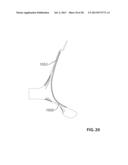 MASK AND METHOD FOR USE IN RESPIRATORY MONITORING AND DIAGNOSTICS diagram and image