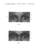 DRY EYE TREATMENT APPARATUS AND METHODS diagram and image