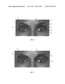 DRY EYE TREATMENT APPARATUS AND METHODS diagram and image