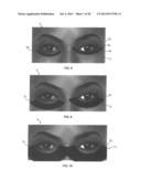 DRY EYE TREATMENT APPARATUS AND METHODS diagram and image