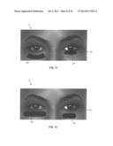 DRY EYE TREATMENT APPARATUS AND METHODS diagram and image