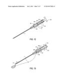 IV Catheter Insertion Device and Method of Using It diagram and image