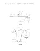 CONTEXT-SENSITIVE FLOW INTERRUPTER AND DRAINAGE OUTFLOW OPTIMIZATION     SYSTEM diagram and image