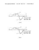 CONTEXT-SENSITIVE FLOW INTERRUPTER AND DRAINAGE OUTFLOW OPTIMIZATION     SYSTEM diagram and image