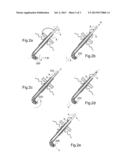 SURGICAL INSTRUMENT IN PARTICULAR FOR PERITONEAL SURGERY diagram and image