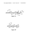 OFF-WALL ELECTRODE DEVICE AND METHODS FOR NERVE MODULATION diagram and image