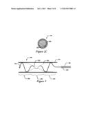 OFF-WALL ELECTRODE DEVICE AND METHODS FOR NERVE MODULATION diagram and image