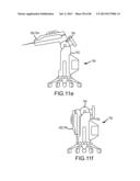 Intuitive user interface control for remote catheter navigation and 3D     mapping and visualization systems diagram and image