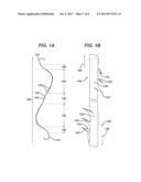 METHODS AND DEVICES FOR SOFT PALATE TISSUE ELEVATION PROCEDURES diagram and image