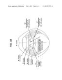 METHODS AND DEVICES FOR SOFT PALATE TISSUE ELEVATION PROCEDURES diagram and image