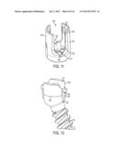 EXTENDED TAB BONE SCREW SYSTEM diagram and image