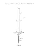 EXTENDED TAB BONE SCREW SYSTEM diagram and image