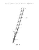 EXTENDED TAB BONE SCREW SYSTEM diagram and image