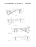 ORTHOPEDIC COMPRESSION PLATE AND METHOD OF SURGERY diagram and image