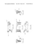 ORTHOPEDIC COMPRESSION PLATE AND METHOD OF SURGERY diagram and image