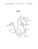 METHODS FOR LIGAMENT RECONSTRUCTION diagram and image