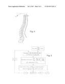 METHOD AND DEVICE FOR DYNAMICALLY DETERMINING THE POSITION AND ORIENTATION     OF THE BONE ELEMENTS OF THE SPINE diagram and image