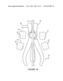 ARROW EXTRACTOR diagram and image