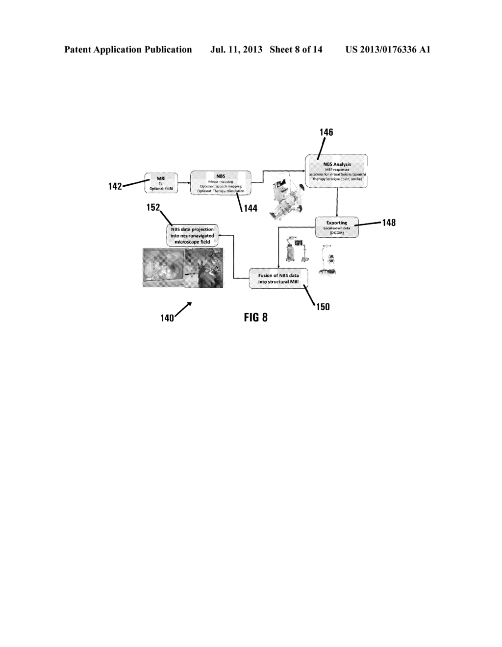 METHOD OF AND SYSTEM FOR OVERLAYING NBS FUNCTIONAL DATA ON A LIVE IMAGE OF     A BRAIN - diagram, schematic, and image 09