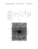 DATA ACQUISITION METHODS FOR REDUCED MOTION ARTIFACTS AND APPLICATIONS IN     OCT ANGIOGRAPHY diagram and image