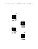 DUAL WINDOW PROCESSING SCHEMES FOR SPECTROSCOPIC OPTICAL COHERENCE     TOMOGRAPHY (OCT) AND FOURIER DOMAIN LOW COHERENCE INTERFEROMETRY diagram and image