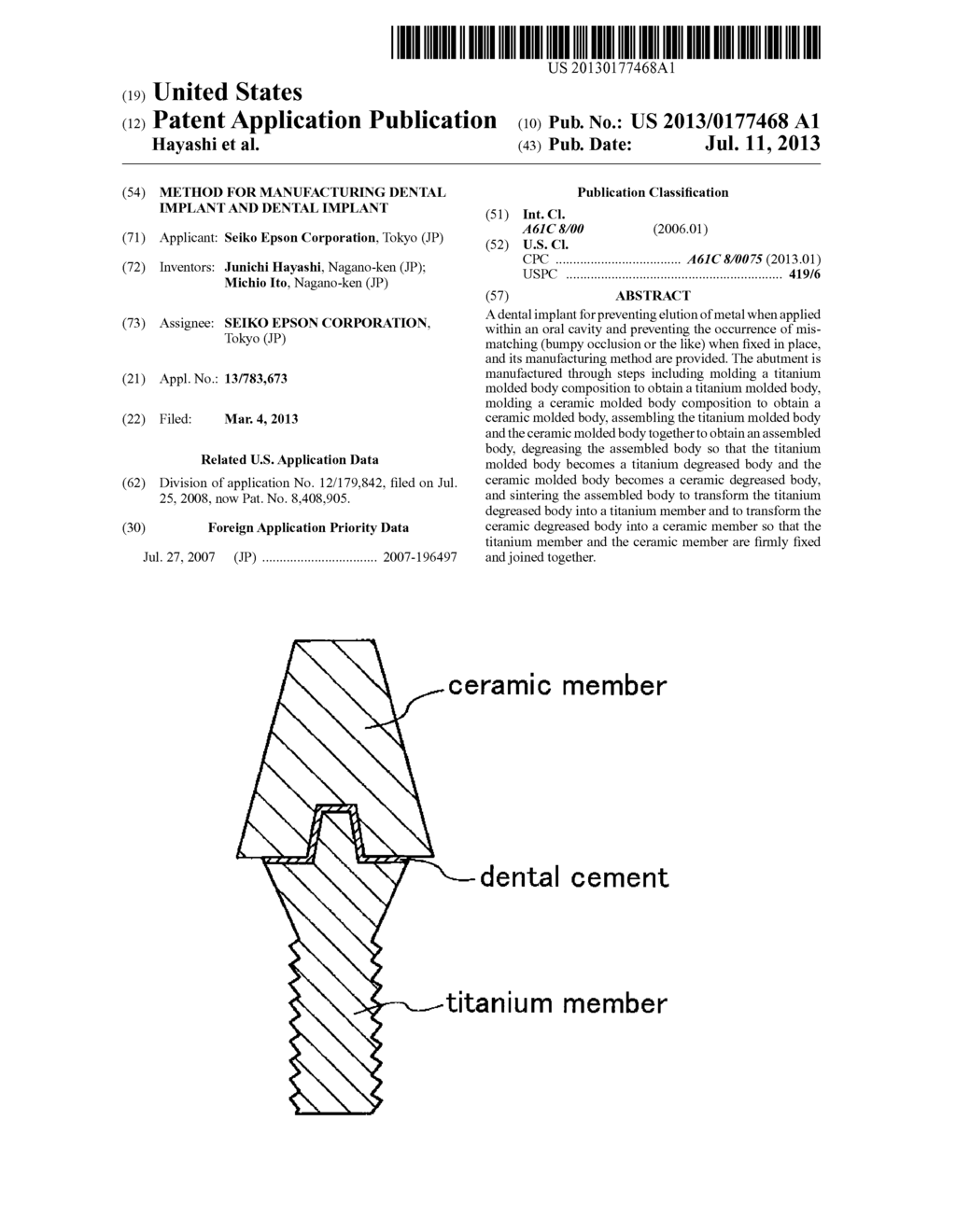 Method for Manufacturing Dental Implant and Dental Implant - diagram, schematic, and image 01