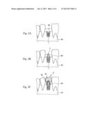 Method for Manufacturing Dental Implant and Dental Implant diagram and image