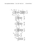 Method for Manufacturing Dental Implant and Dental Implant diagram and image