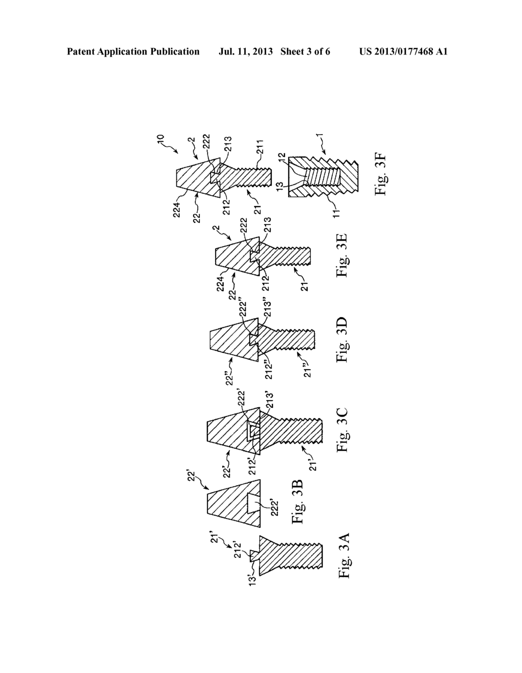 Method for Manufacturing Dental Implant and Dental Implant - diagram, schematic, and image 04