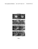 METHODS AND COMPOSITIONS FOR MODULATING OCULAR DAMAGE diagram and image