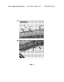 METHODS AND COMPOSITIONS FOR MODULATING OCULAR DAMAGE diagram and image