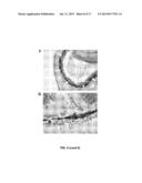 METHODS AND COMPOSITIONS FOR MODULATING OCULAR DAMAGE diagram and image