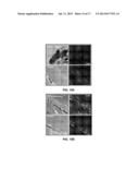 METHODS AND COMPOSITIONS FOR MODULATING OCULAR DAMAGE diagram and image