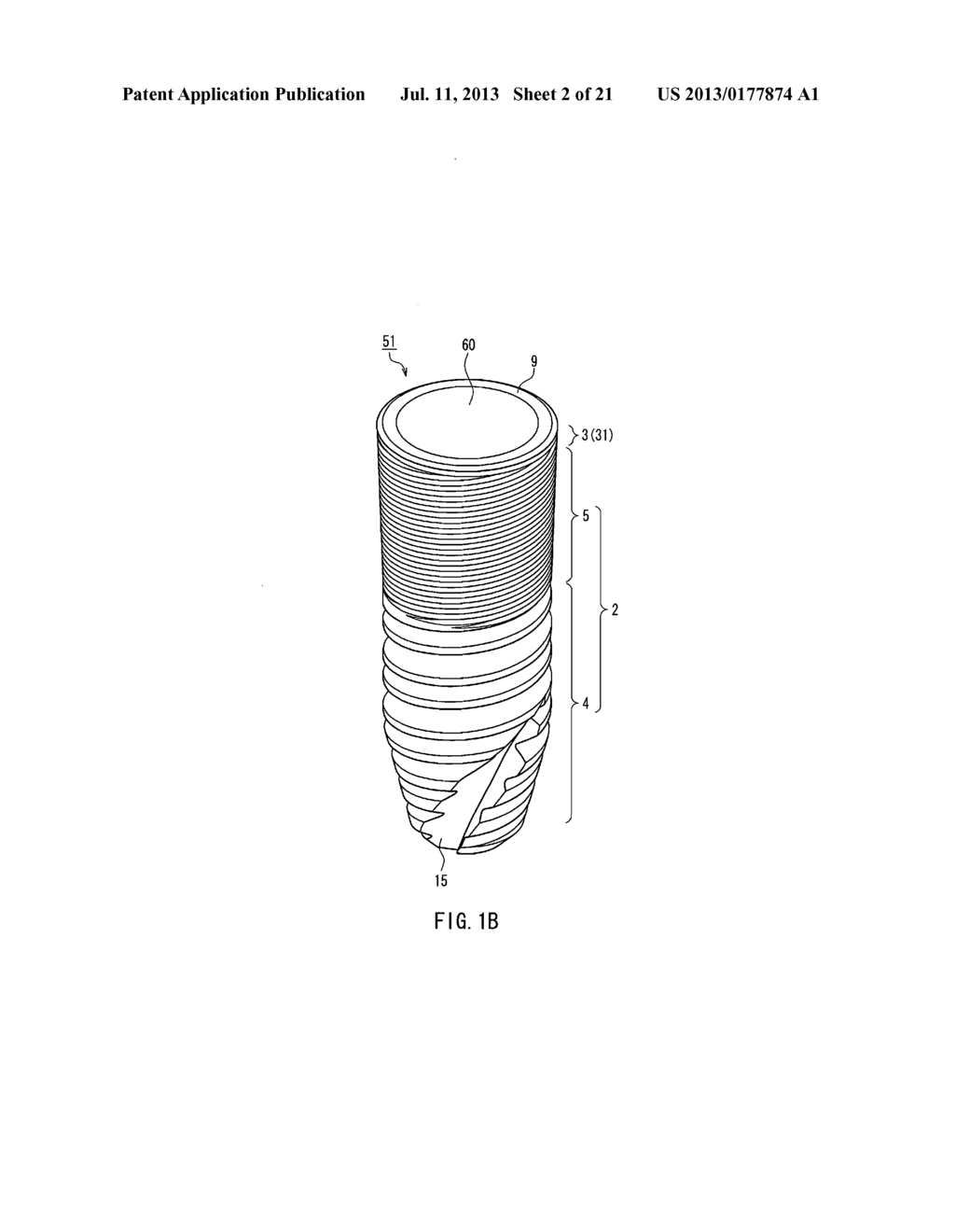 DENTAL IMPLANT - diagram, schematic, and image 03