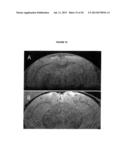 SUBSTITUTED CIS- AND TRANS-STILBENES AS THERAPEUTIC AGENTS diagram and image