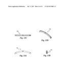 TISSUE DIGESTION METHOD AND APPARATUS diagram and image