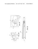 METHODS, INSTRUMENTS AND DEVICES FOR EXTRAGASTIC REDUCTION OF STOMACH     VOLUME diagram and image